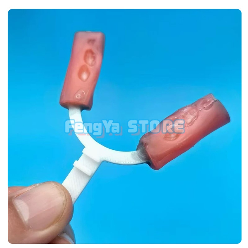 10個/袋入り 歯科矯正用下顎延長バイトフォーク 歯科ラボ  - 3D Printing Orthodontics のレビューと価格