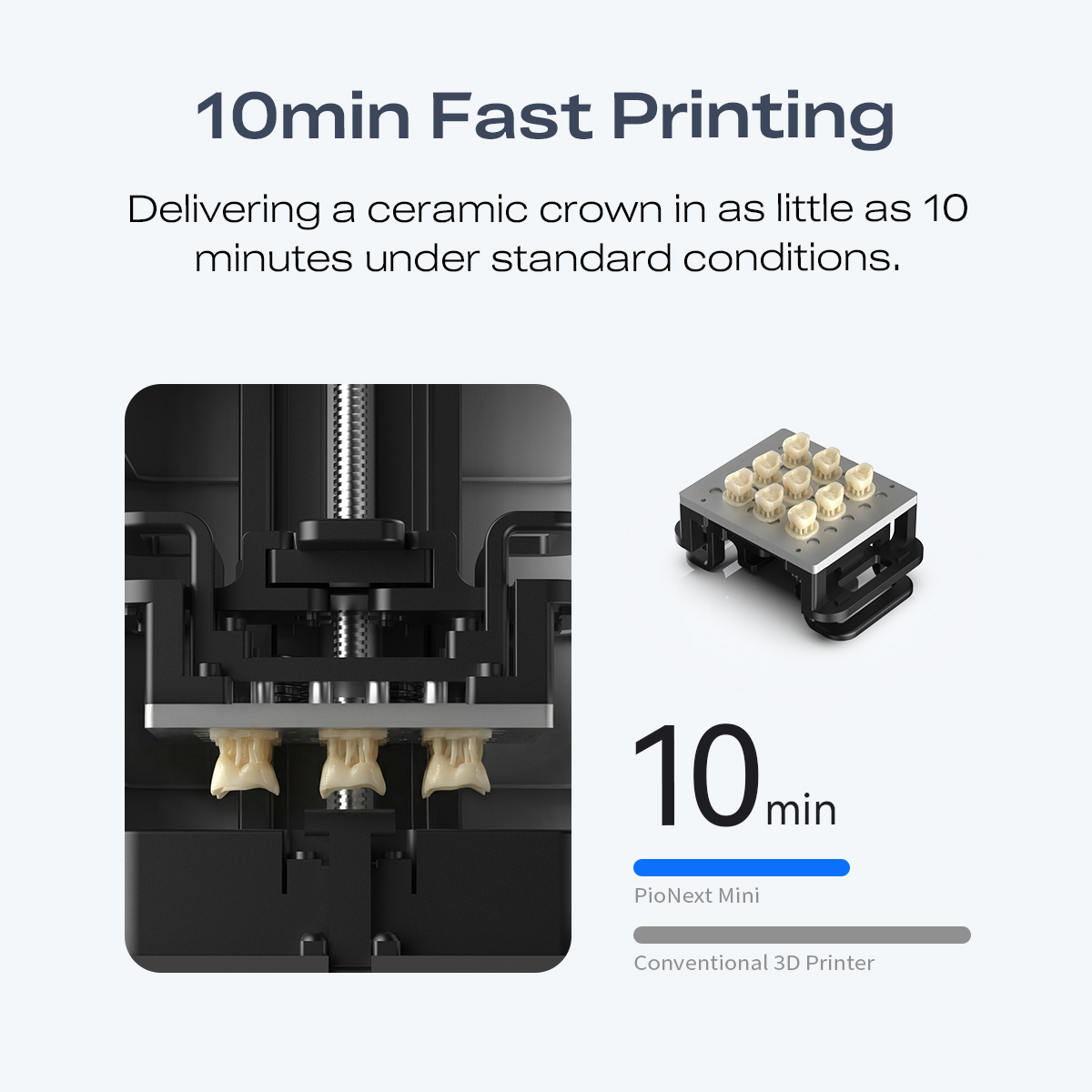 ミニ高精度歯科用3Dプリンター 9K解像度 3Dプリント用矯 - 3D Printing Orthodontics のレビューと価格