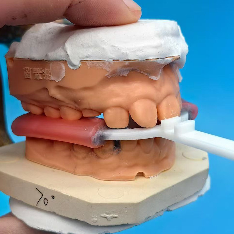 10個/袋入り 歯科用バイトフォーク 矯正用下顎延長器具 歯 - 3D Printing Orthodontics のレビューと価格