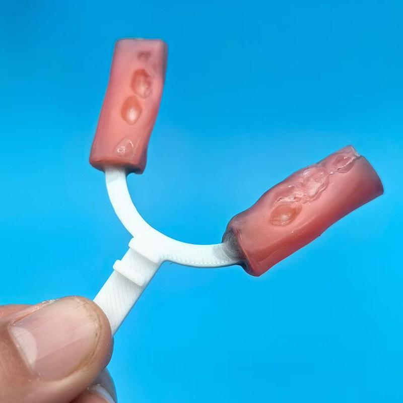 10個/袋入り 歯科用バイトフォーク 矯正用下顎延長器具 歯 - 3D Printing Orthodontics のレビューと価格