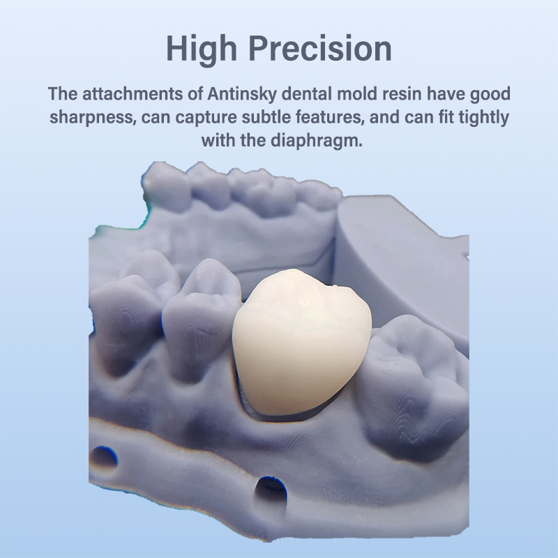 Antinsky-歯科用モデル樹脂,高精度,低収縮,滑らかな - 3D Printing Orthodontics のレビューと価格